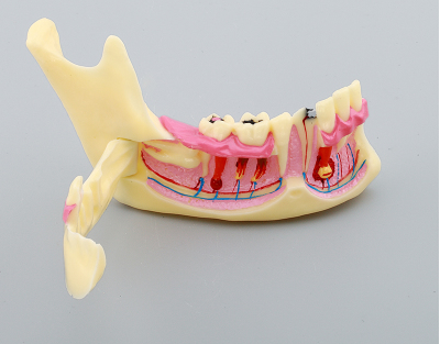 Dental Teeth Model